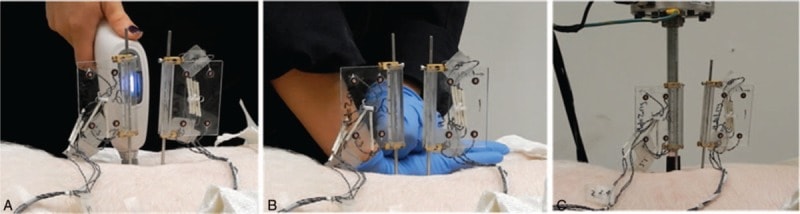 Spinal Tissue Loading Created by Different Methods of Spinal Manipulative Therapy Application. 1